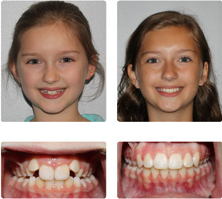 hopkinton orthodontist