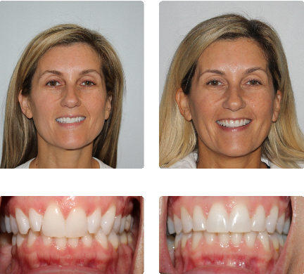 hopkinton orthodontist