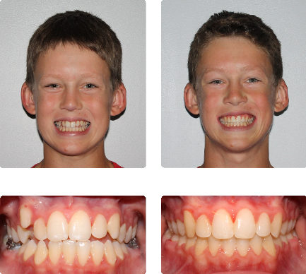 hopkinton orthodontist