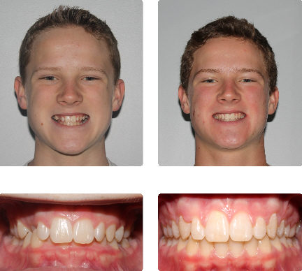 hopkinton orthodontist