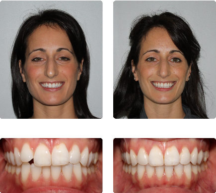 hopkinton orthodontist