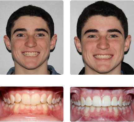 hopkinton orthodontist