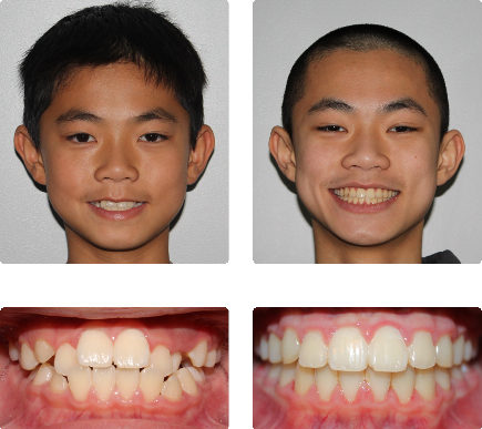 hopkinton orthodontist